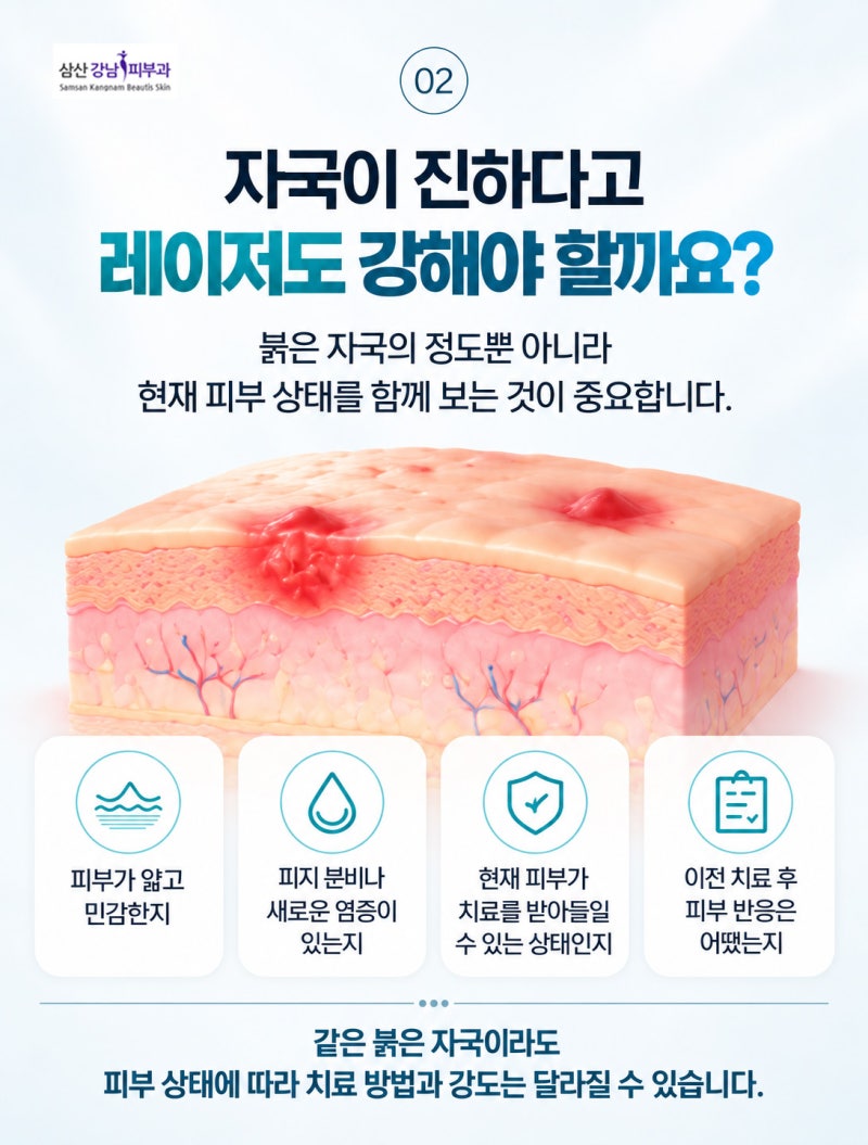 울산 여드름 붉은 자국 치료의 포인트 아드바티엑스 + 리쥬란 사진 2