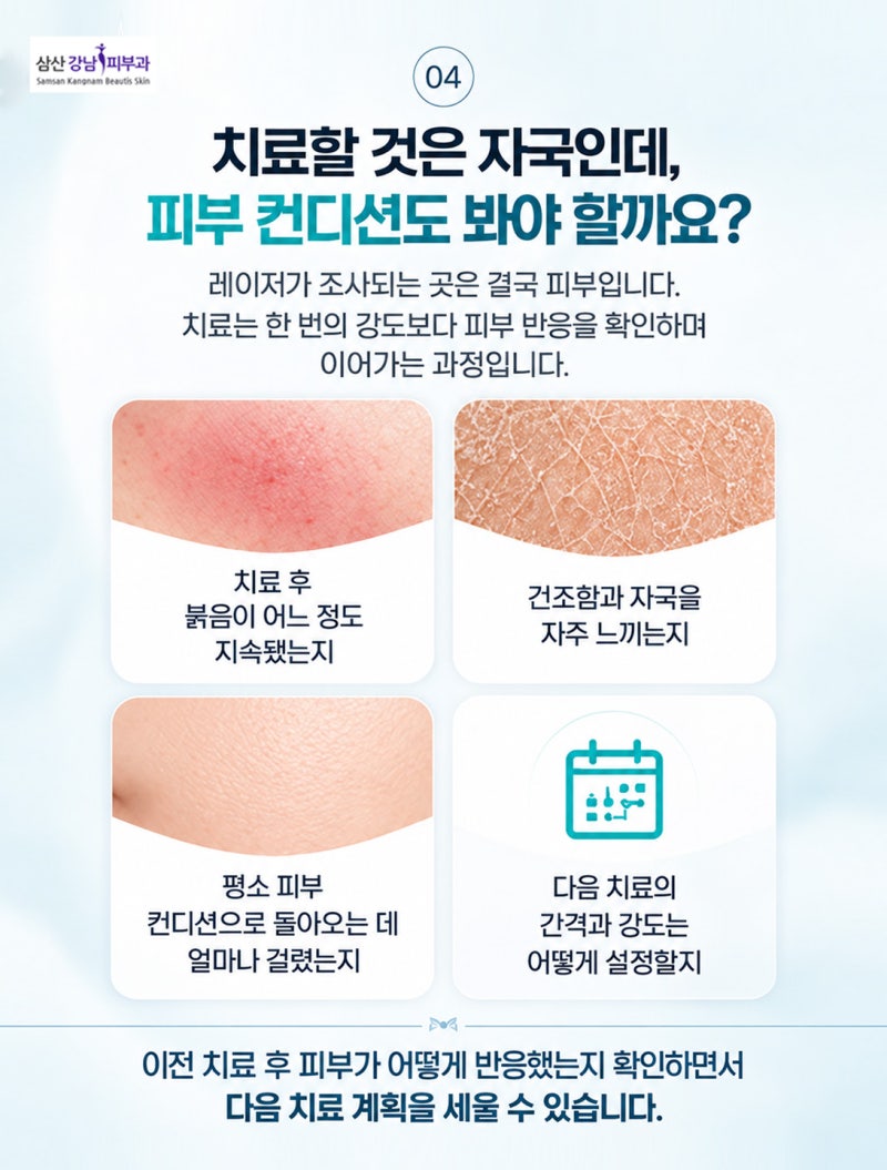 울산 여드름 붉은 자국 치료의 포인트 아드바티엑스 + 리쥬란 사진 4